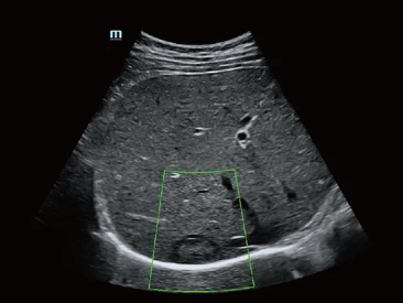 УЗИ аппарат Mindray Resona 6 Exp фото 4