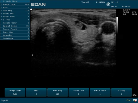 УЗИ аппарат Edan U50 Prime Edition фото 37