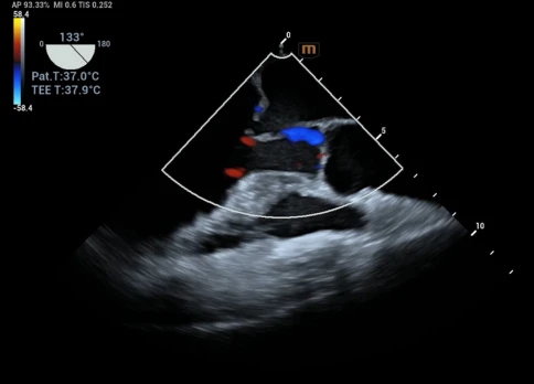УЗИ аппарат Mindray Recho R9 фото 22