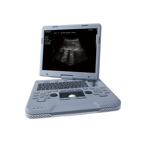 УЗИ аппарат SIUI Apogee 1000 Neo фото 2