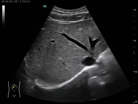 УЗИ аппарат Mindray MX3 фото 4
