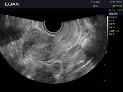УЗИ аппарат Edan Acclarix AX3 фото 24