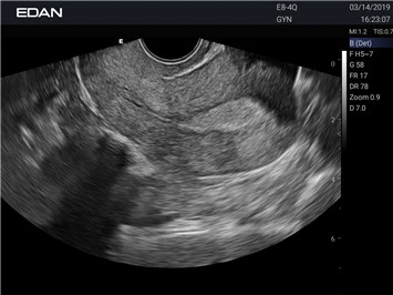 УЗИ аппарат Edan Acclarix AX2 фото 11