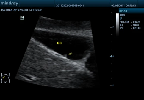 УЗИ аппарат Mindray DP-50 Vet фото 9