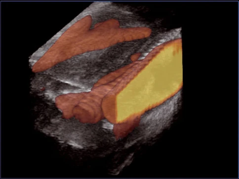 УЗИ аппарат Esaote MyLab Twice фото 7