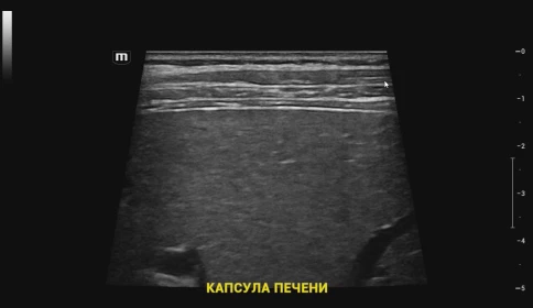 Ультразвуковой аппарат Mindray Resona I9 Exp фото 9
