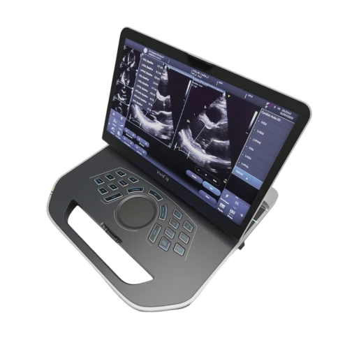 Портативная ультразвуковая система GE Healthcare Vivid iQ фото 1