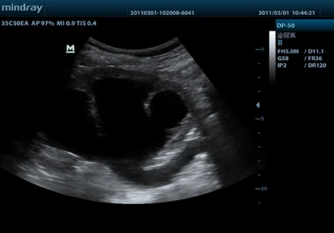 УЗИ аппарат Mindray DP-50 Vet фото 8