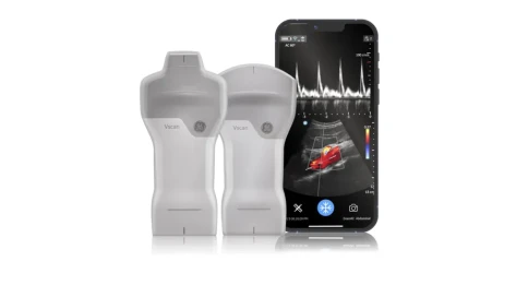 УЗИ аппарат GE HealthCare Vscan Air фото 5
