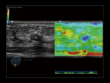 УЗИ аппарат Mindray Resona R9 фото 12