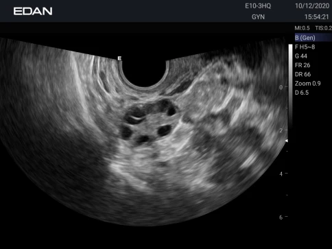 УЗИ аппарат Edan Acclarix AX3 фото 52