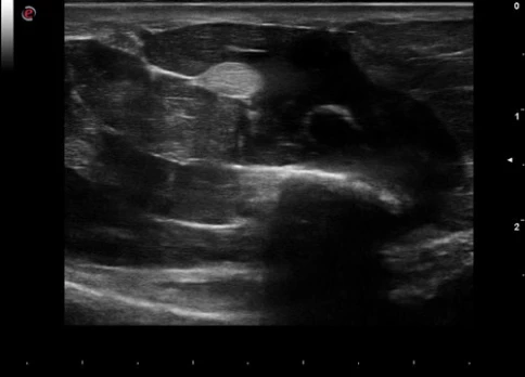УЗИ аппарат Esaote MyLab Gamma фото 8