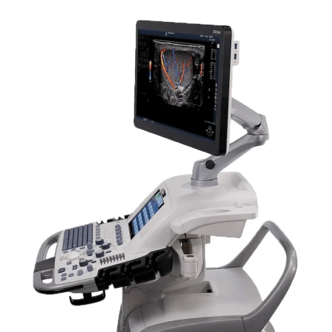 Ультразвуковая диагностическая система GE Healthcare Vivid E95 фото 3