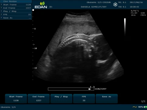 УЗИ аппарат Edan U50 Prime Edition фото 26