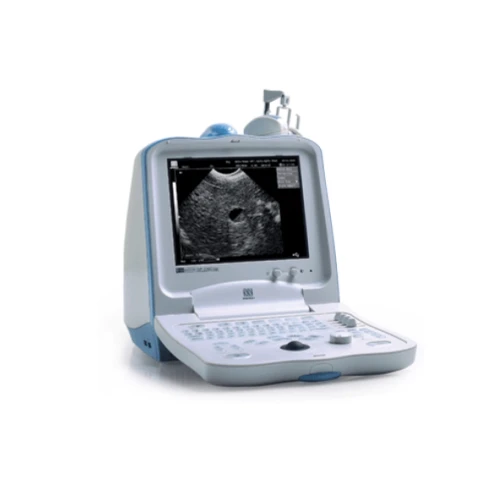 УЗИ аппарат Mindray DP 3300 фото 1