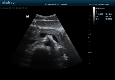 УЗИ аппарат Mindray DP-50 фото 9